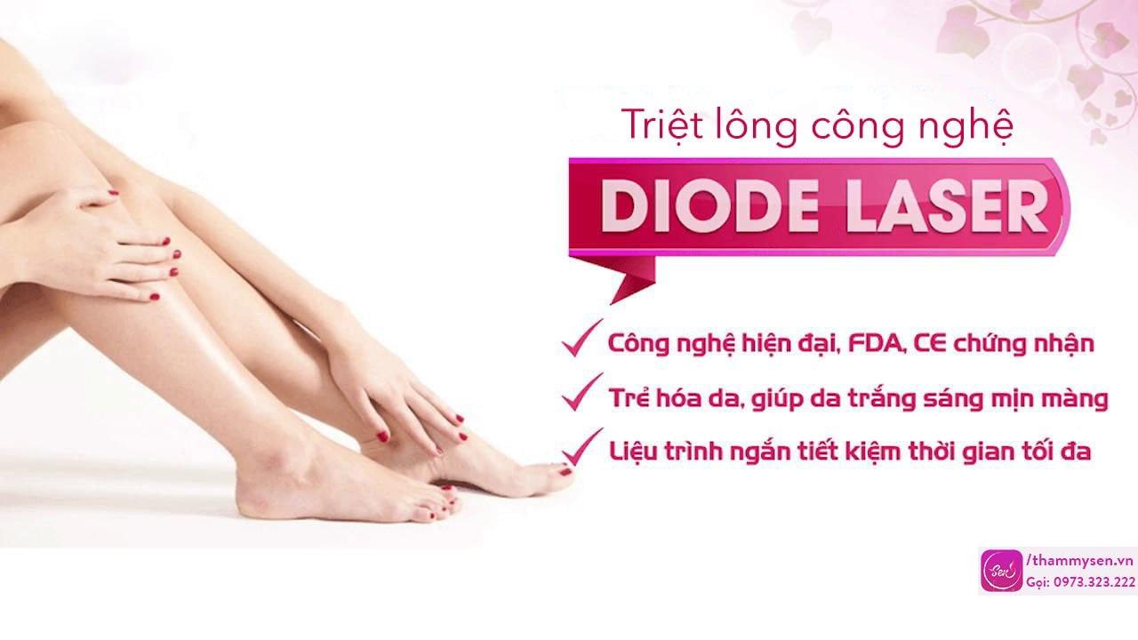 triệt lông diode laser