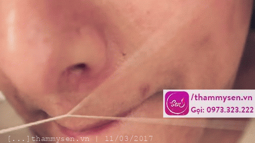 cách tẩy lông mặt 