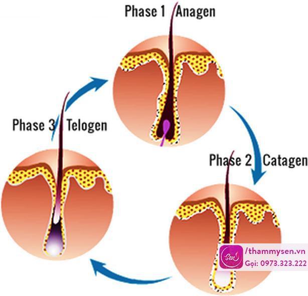 Triệt lông hiệu quả có mọc lại không