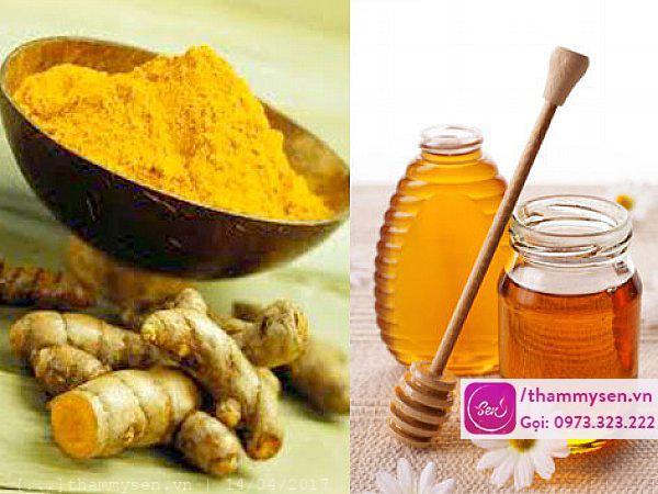 Trị mụn bằng mật ong và nghệ có tác dụng rất nhanh