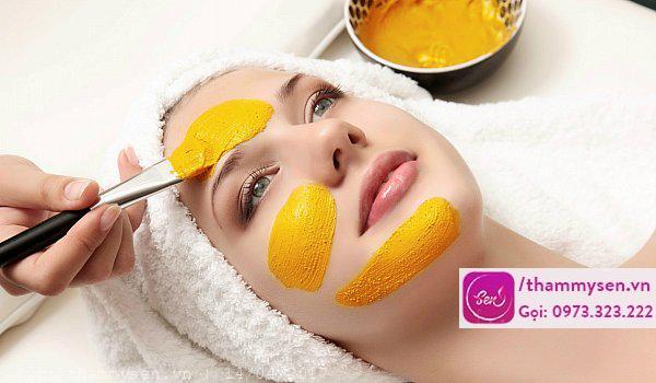 trị mụn bằng mật ong và nghệ