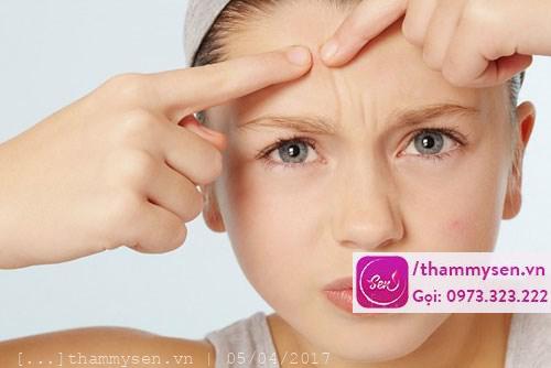 Cách nặn mụn đúng cách