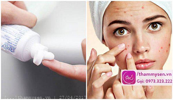Cách trị mụn bọc nhanh nhất tại nhà bằng kem đánh răng