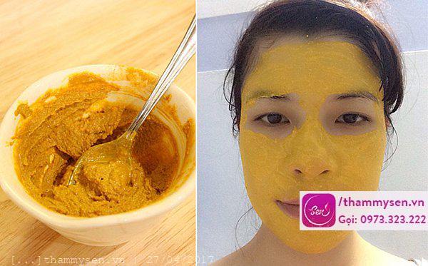 Cách trị mụn bọc ở mũi hiệu quả nhất bằng bột nghệ và bột yến mạch Cách trị mụn bọc ở mũi hiệu quả nhất bằng bột nghệ