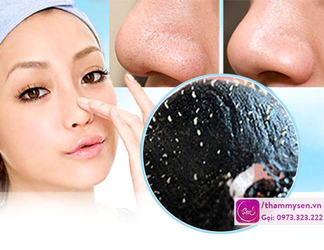 Cách trị mụn đầu đen ở mũi bằng miếng lột mụn