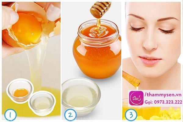 Cách trị mụn trứng cá đơn giản và hiệu quả 