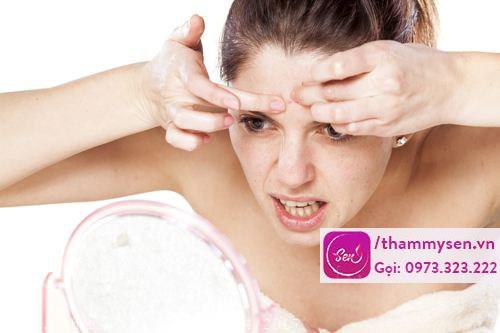 Mụn trứng cá ở trán