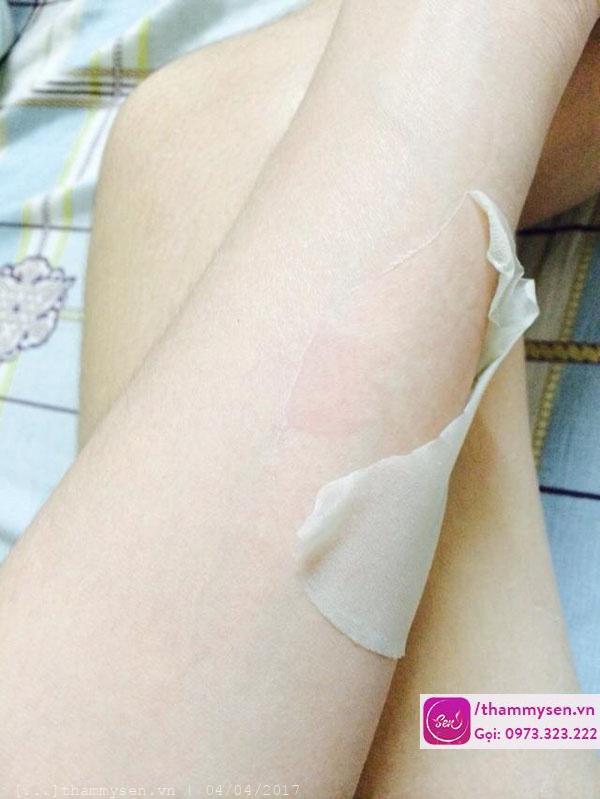 Tắm trắng có ảnh hưởng gì không