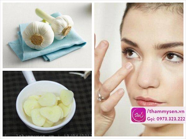 Cách trị mụn hiệu quả nhất từ tỏi Cách trị mụn hiệu quả nhất từ tỏi