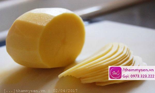 Trị mụn bằng khoai tây hiệu quả tại nhà