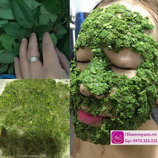  trị mụn bằng lá khế