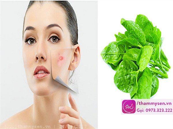 Trị mụn bằng rau mồng tơi xua tan mụn cóc
