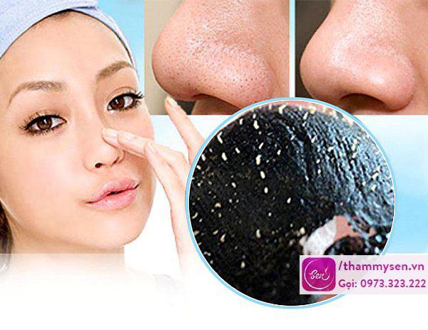 Trị mụn đầu đen