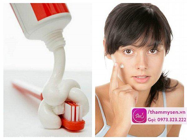 Cách trị mụn trứng cá nhanh nhất cho nữ bằng kem đánh răng trị mụn trứng cá nhanh nhất