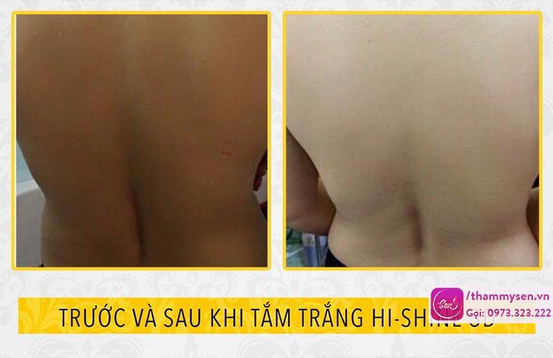 ket qua tam trang hi shine 3d