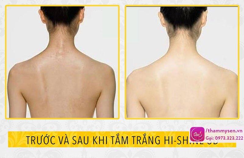 ket qua tam trang hi shine 3d