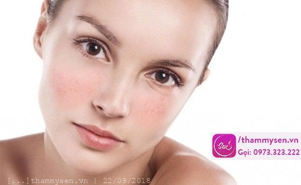 liệu trình trị nám