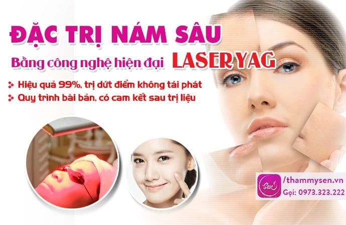 trị nám tàn nhang