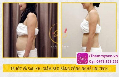 Hình ảnh này chưa có thuộc tính alt; tên tệp của nó là giam-beo-cong-nghe-uni-tech-2.jpg