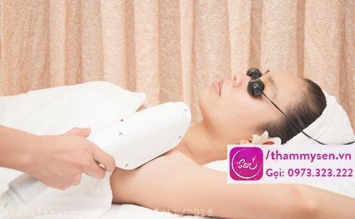 triệt lông nách