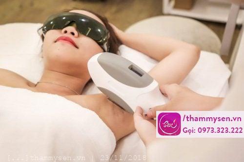 triệt lông nách vĩnh viễn bằng máy triệt lạnh
