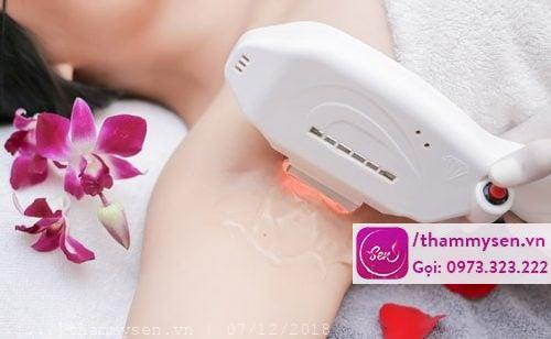 địa chỉ spa triệt lông vĩnh viễn uy tín tại hà nội