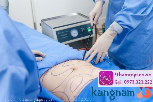 dia-diem-giam-beo-keangnam