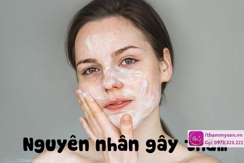 nguyen-nhan-gay-tham