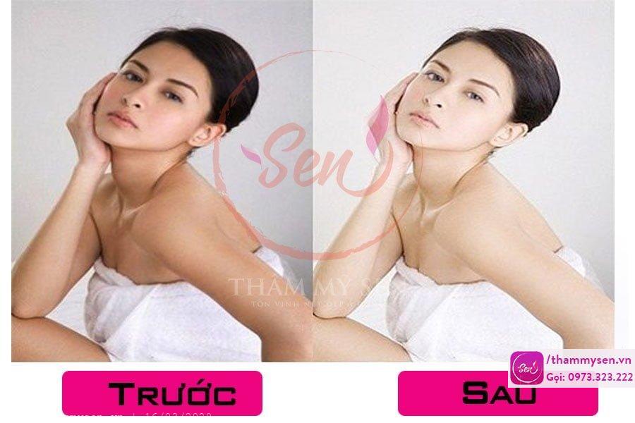 Hình ảnh sau khi tắm trắng của khách hàng