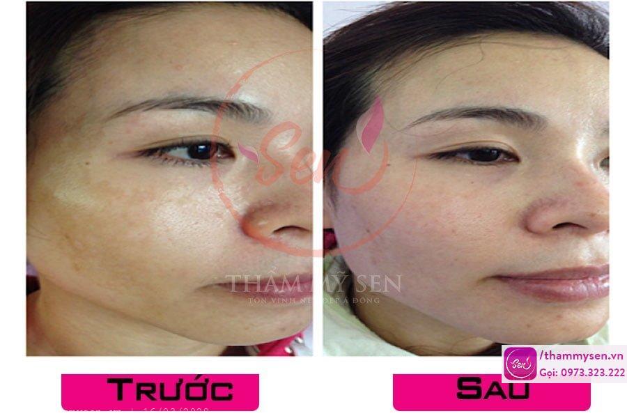 ket-qua-thuc-hien
