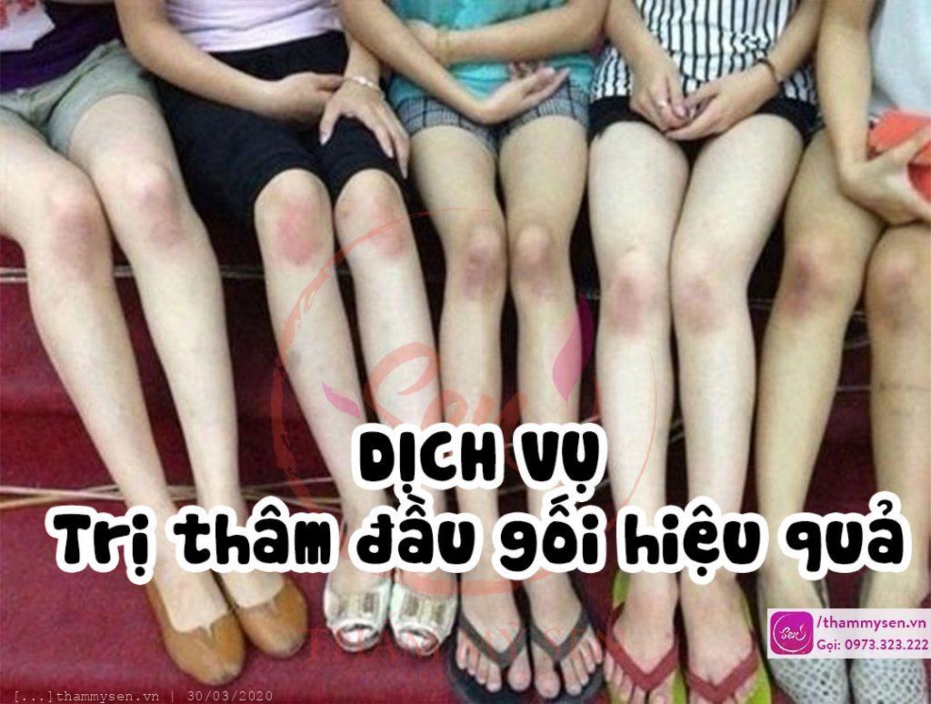tri-tham-dau-goi