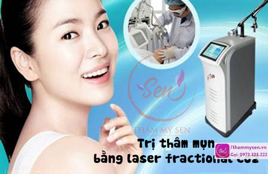 Trị thâm mụn bằng laser fractional co2