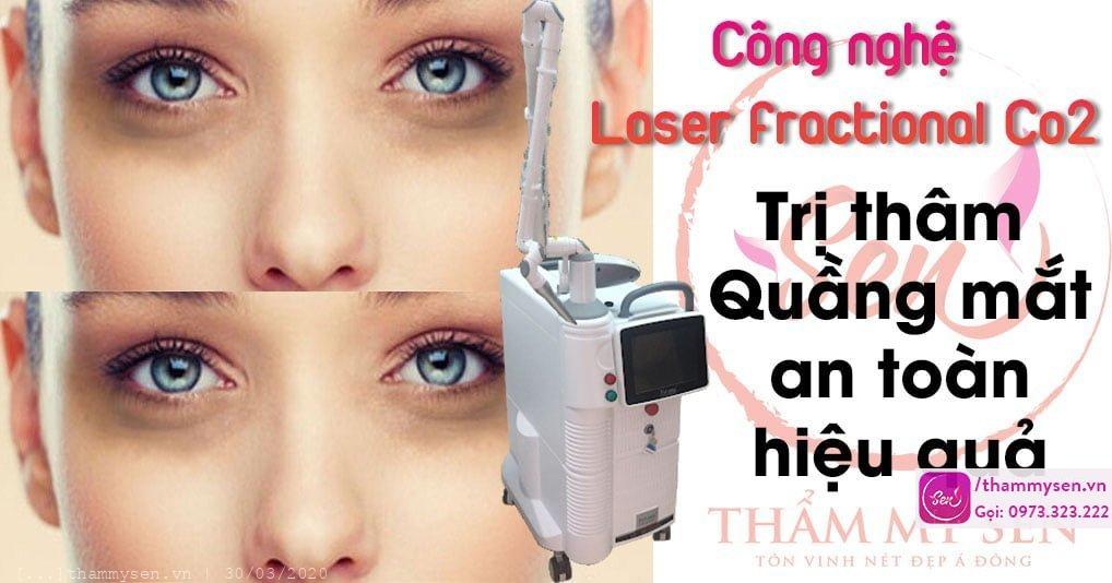cong-nghe-tham-quang-mat