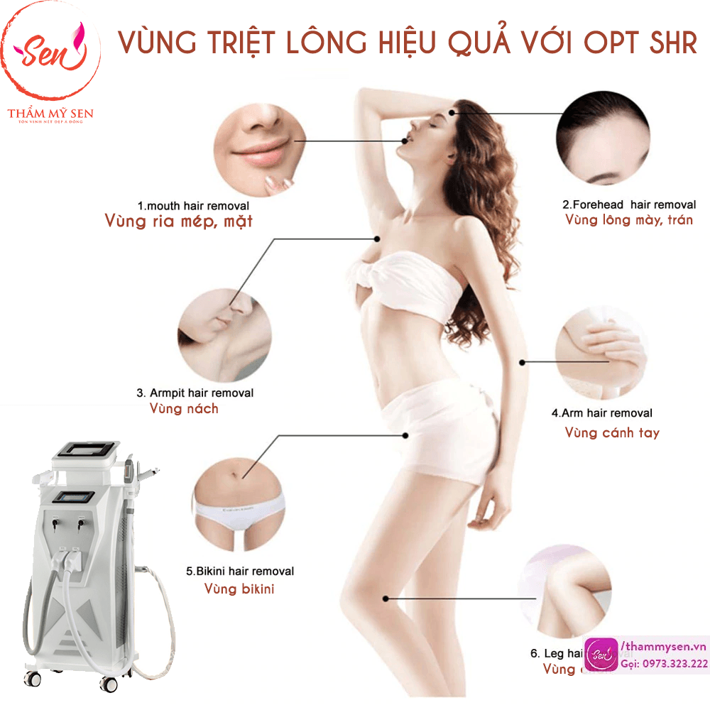 Các vùng triệt lông vĩnh viễn trên cơ thể