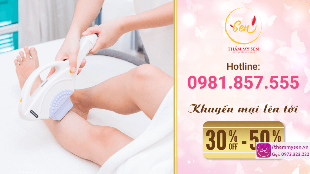 Khuyến mãi triệt lông vĩnh viễn