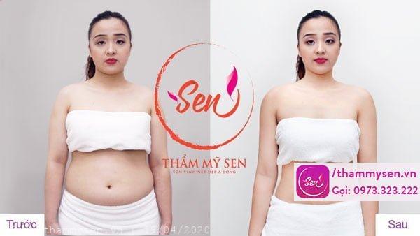 Khách hàng sau khi sử dụng liệu trình thành công