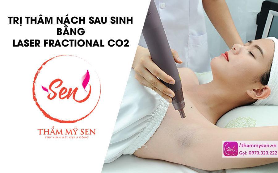 TRI-THAM-NACH-SAU-SINH-BANG-LASER