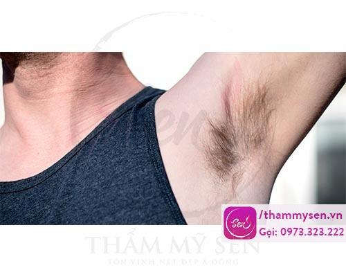 Cạo - Wax hay triệt lông nách đúng theo hướng sẽ đem lại kết quả cao nhất.