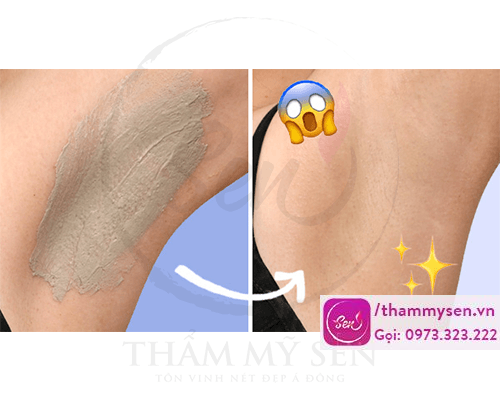 Tẩy da chết và chăm sóc da vùng nách cũng cho kết quả rất tốt