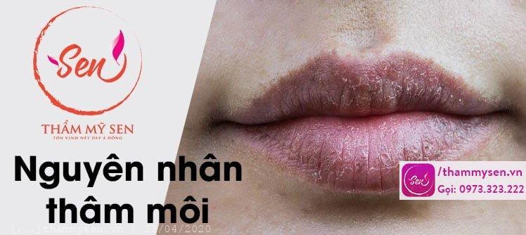 nguyen-nhan-moi-tham-den