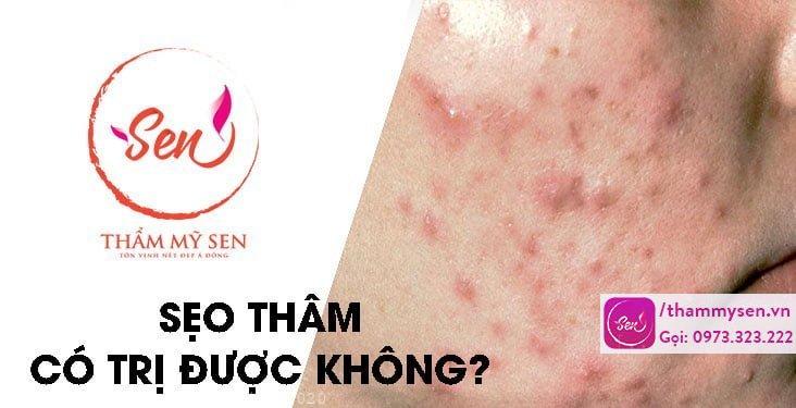 seo-tham-co-tri-duoc-khong
