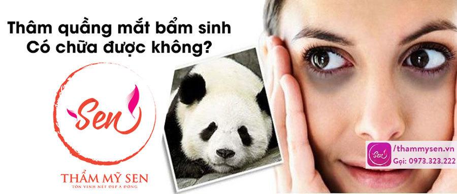 tham-quang-mat-bam-sinh-co-chua-duoc-khong