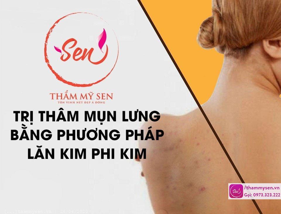 tri-tham-mun-lung-bang-phuong-phap-lan-kim-phi-kim.jpg