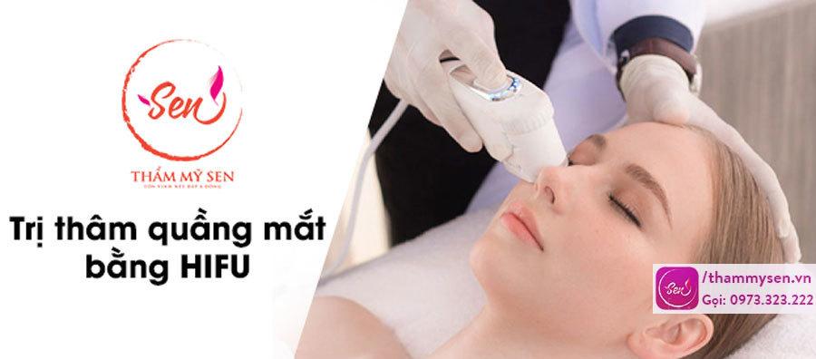 tri-tham-quang-mat-bang-hifu