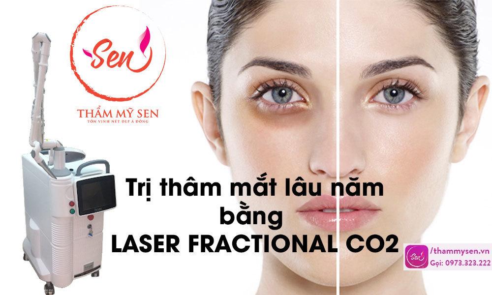 tri-tham-quang-mat-lau-nam-bang-laser