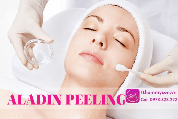 Điều trị mụn bằng Aladin Treatment