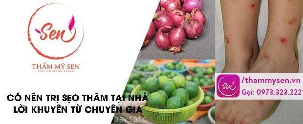 co-nen-tri-seo-tham-o-nha
