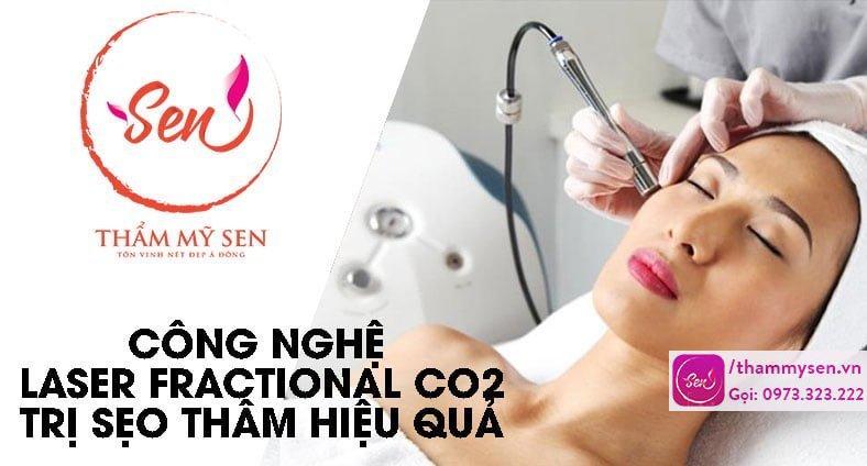 cong-nghe-laser-fractional-co2-tri-seo-tham