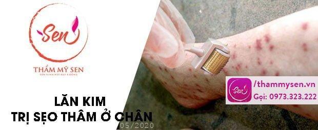 lan-kim-tri-seo-tham-o-chan