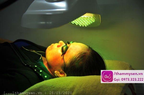 Green Elight trị mụn